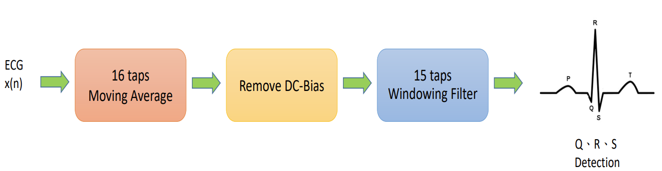 Flow of a ECG QRS detection algorithm